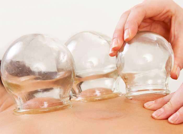 Cupping Therapy Cary, Fuquay Varina, Zebulon, NC